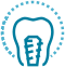 Implantes Dentales