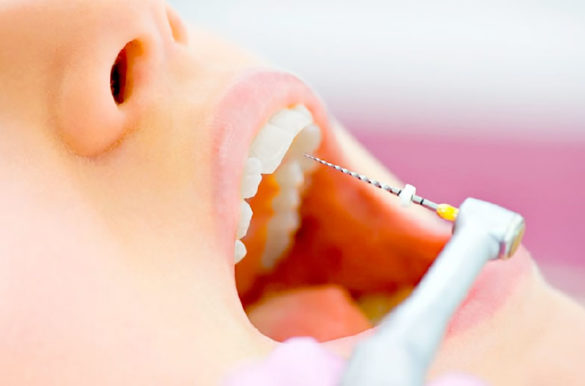 Endodoncia Implantek Quito
