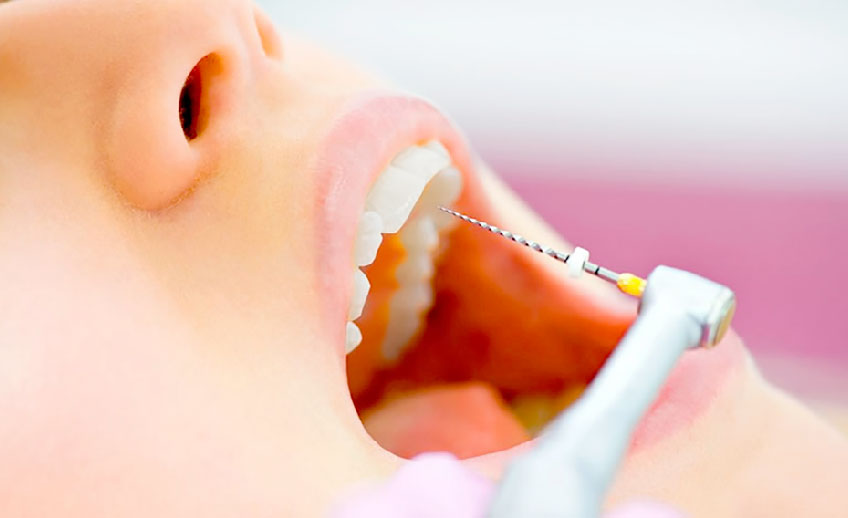 Endodoncia Implantek Quito